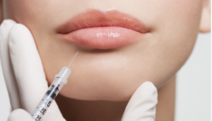 rha vs restylane vs juvederm