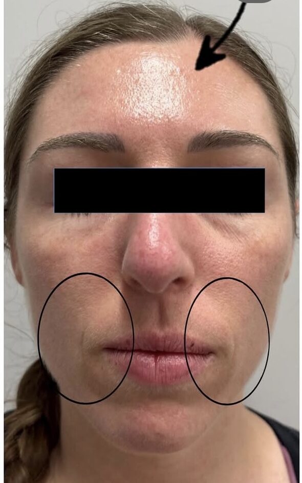 Facials After Patient 5