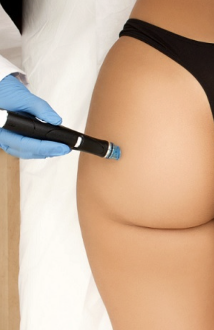 HydraFacial body treatment buttocks Ashburn Northern Virginia