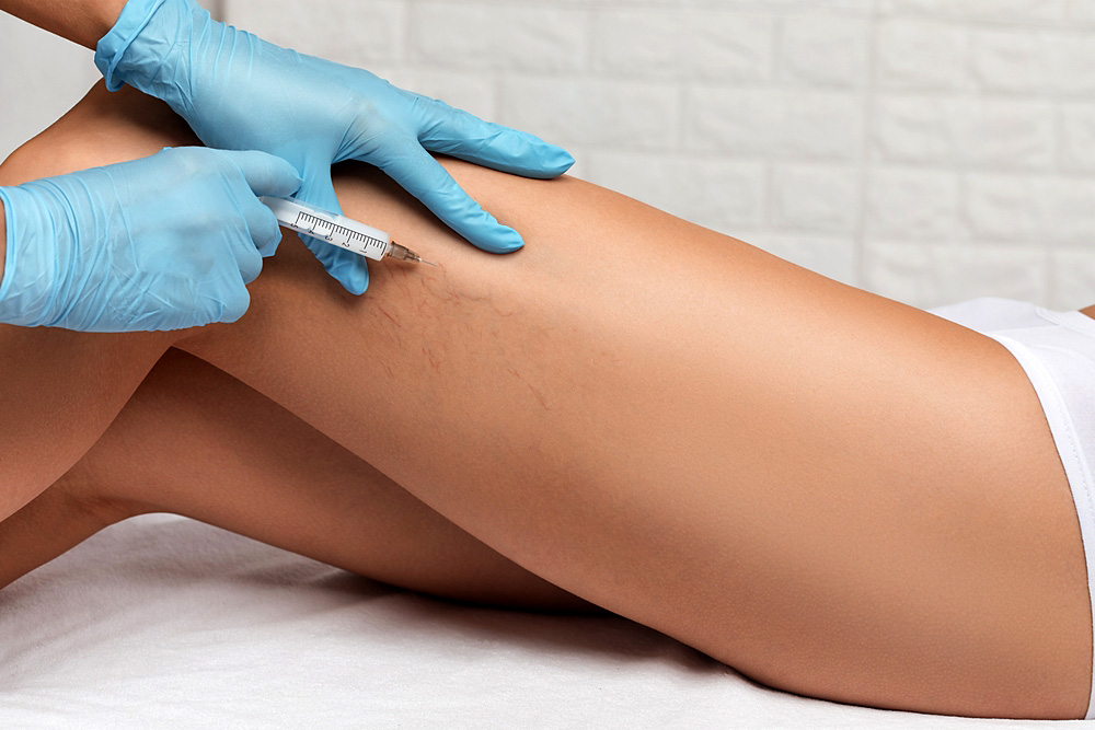 Healthcare professional in blue gloves administering a syringe injection into a patient’s thigh (close-up).