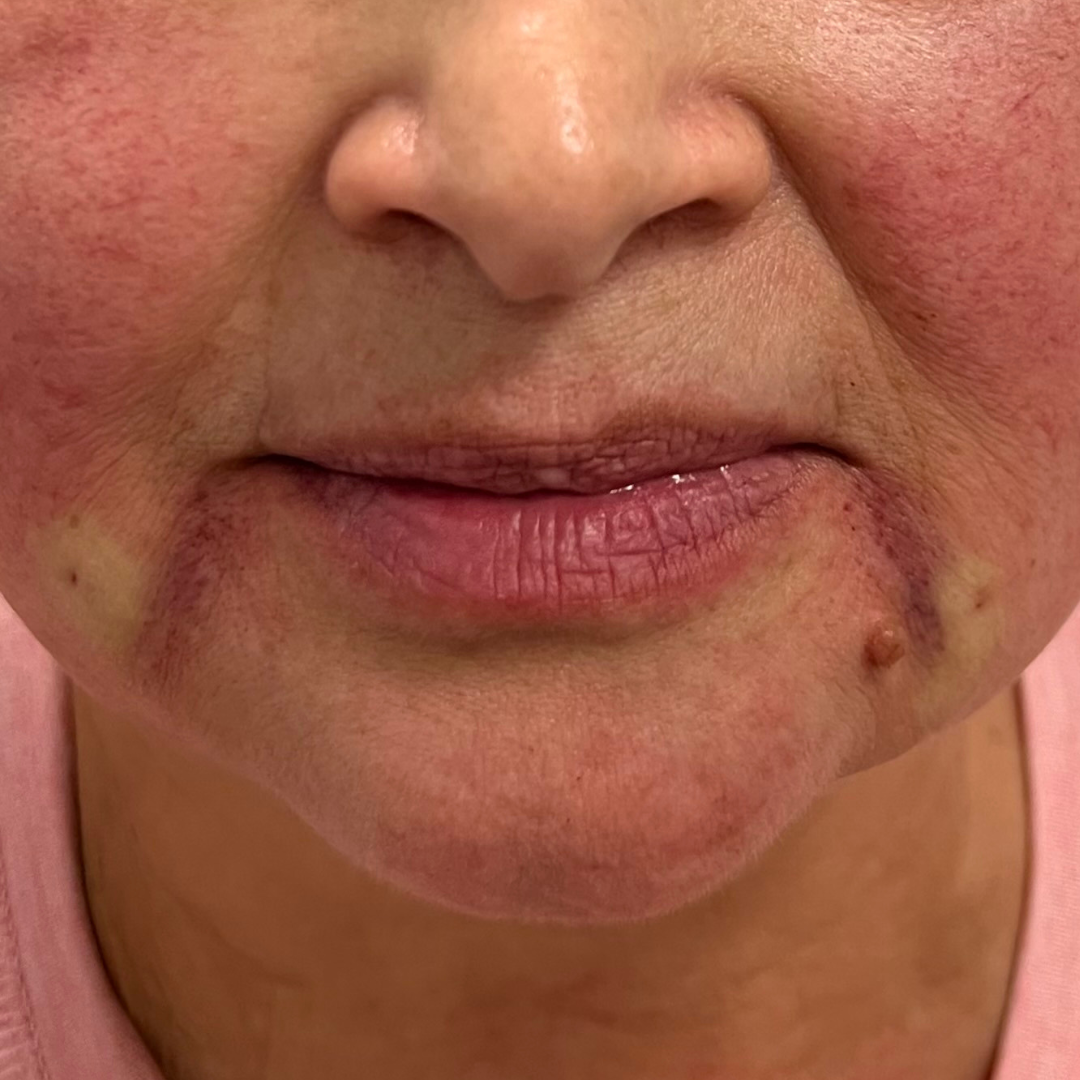 Lines Archives Mountcastle Medical Spa and Laser Center