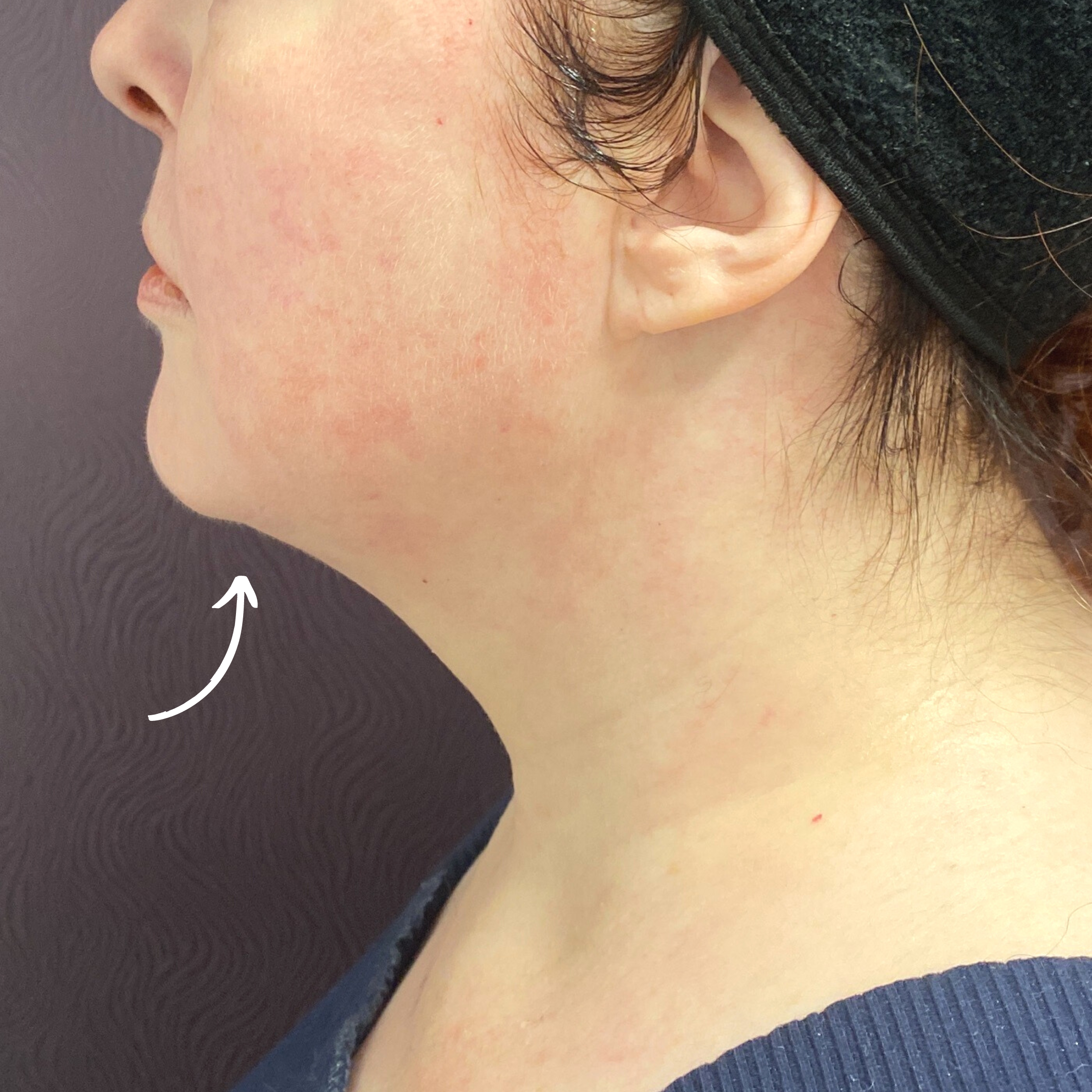 Medical Spa After Patient 9