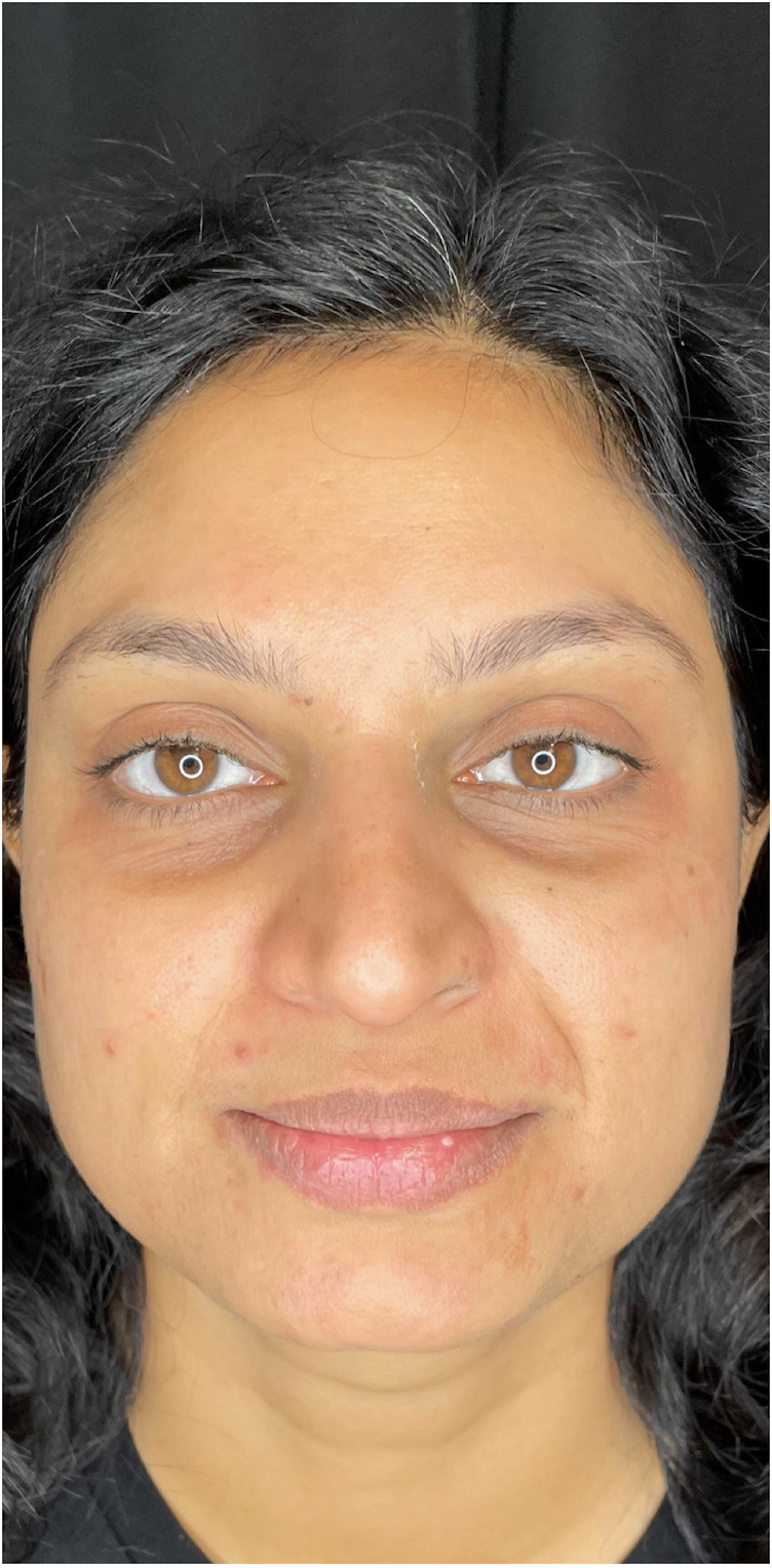 Medical Grade Skin Care After Patient 4