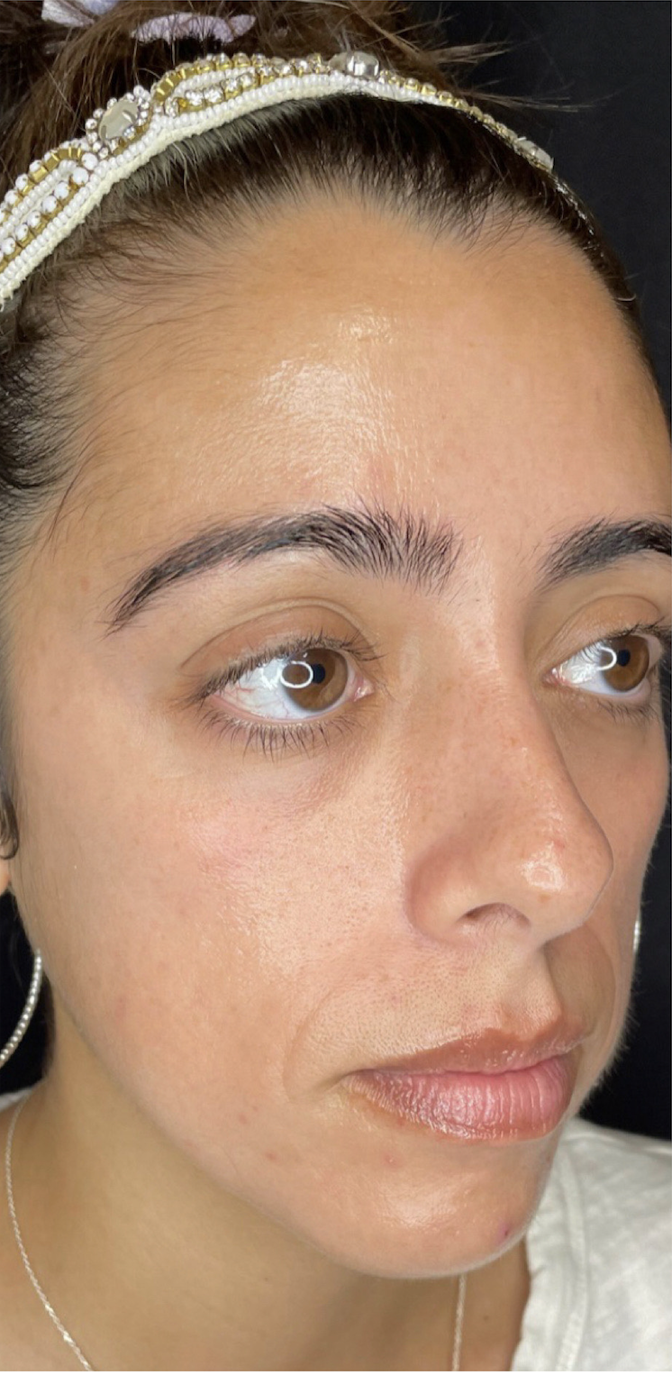 Medical Grade Skin Care After Patient 5